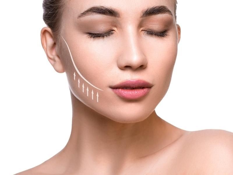 Phương pháp căng da mặt bằng chỉ Collagen có tốt không?