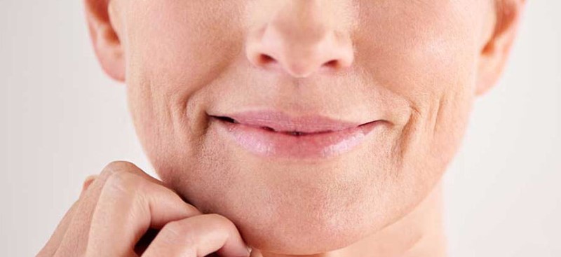 Đối tượng nào nên thực hiện tiêm filler rãnh cười