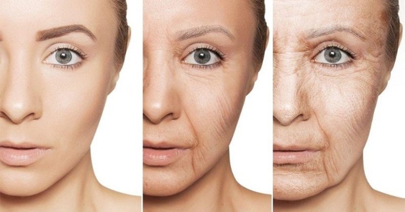 Phương pháp tiêm botox căng da mặt có các công dụng nào?
