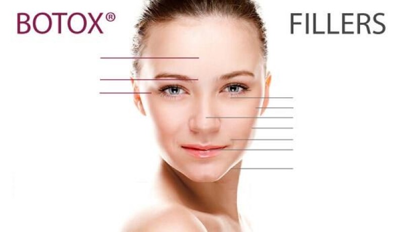 Giữa tiêm filler và tiêm botox - cái nào tốt hơn?