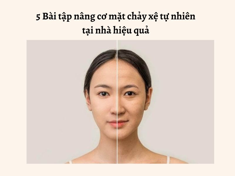 nâng cơ mặt chảy xệ hà nội