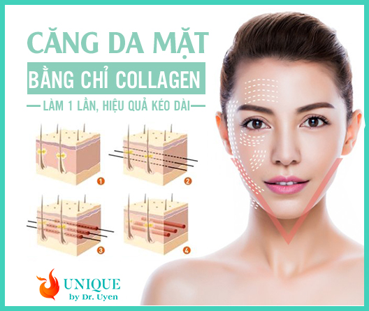 nâng cơ mặt chảy xệ hà nội