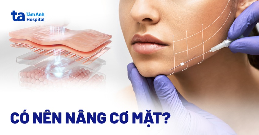 nâng cơ mặt chảy xệ hà nội