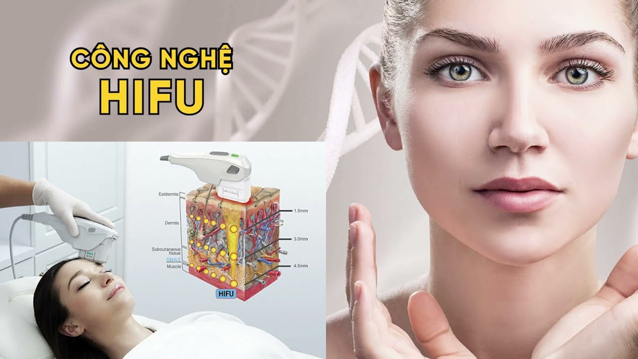 Nâng Cơ Mặt Hifu Giải Pháp Tối Ưu Để Duy Trì Vẻ Đẹp