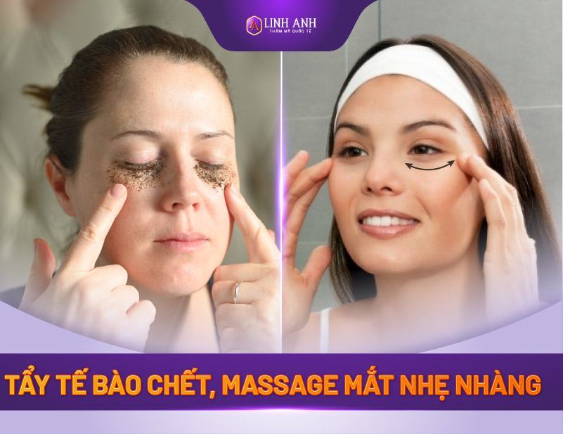 Xóa Nếp Nhăn Đuôi Mắt Giải Pháp Làm Trẻ Hóa Vùng Da Nhạy Cảm